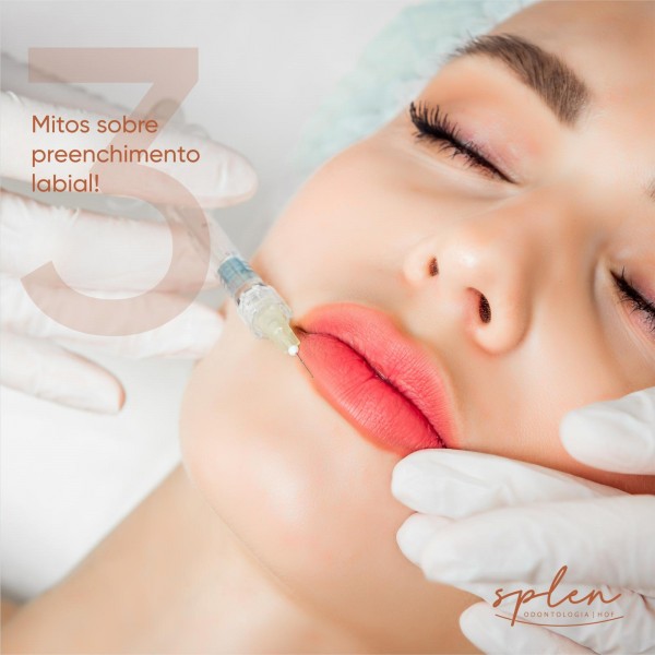 Preenchimento labial, mito ou verdade?