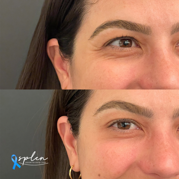 Antes e Depois. Confira!