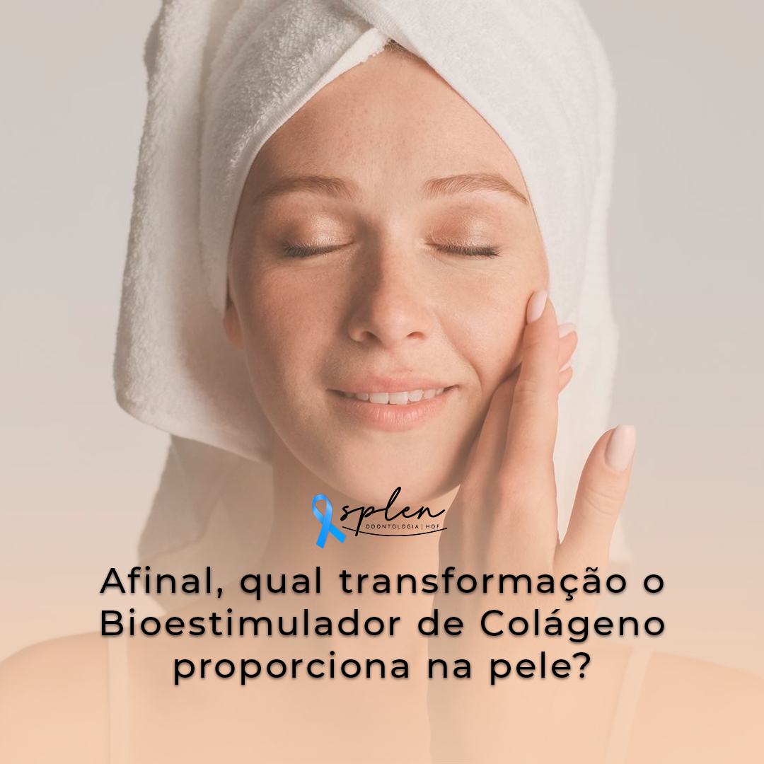 Afinal, qual transformação o Bioestimulador de Colágeno proporciona na pele?